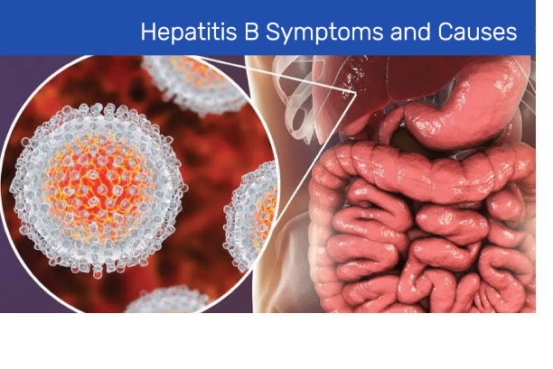 Hepatitis B Symptoms and Causes